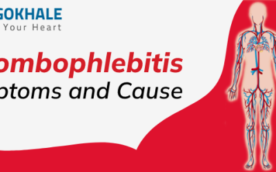 Thrombophlebitis Symptoms and Causes