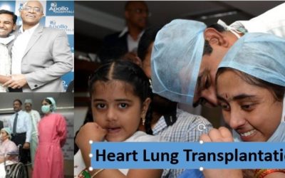 Heart and Lung Transplantation Surgeries
